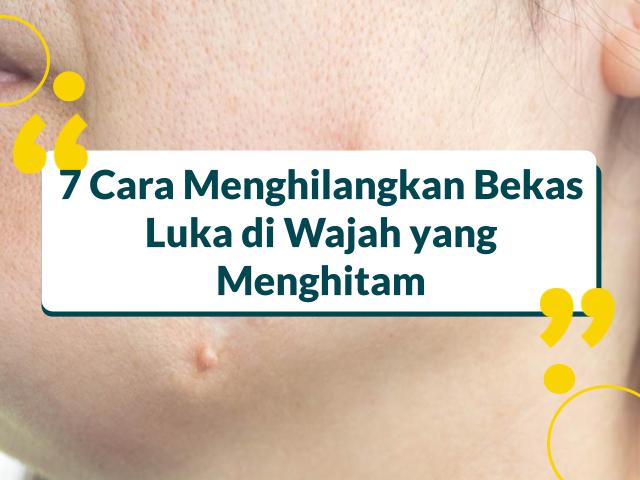 Cara Menghilangkan Bekas Luka di Wajah yang Menghitam