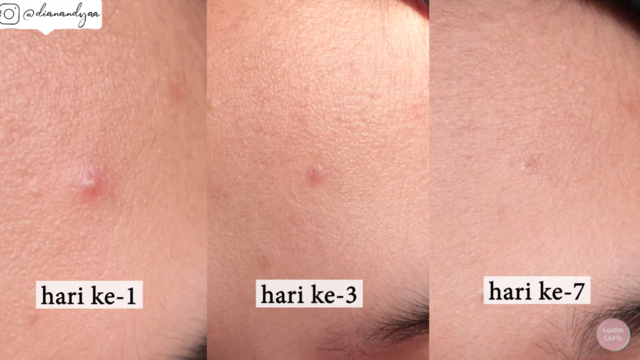 scarlett whitening acne essence toner