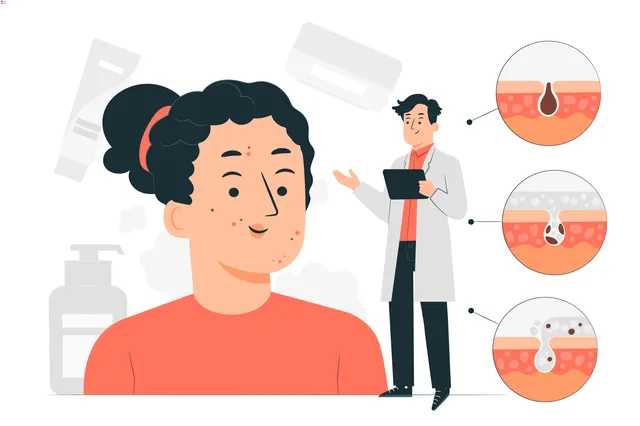 5 Cara Menghilangkan Flek Hitam di Wajah yang Membandel