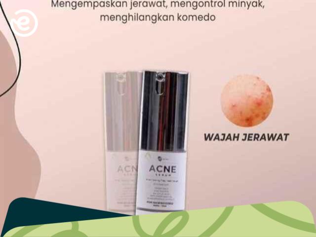 Serum Acne MS Glow