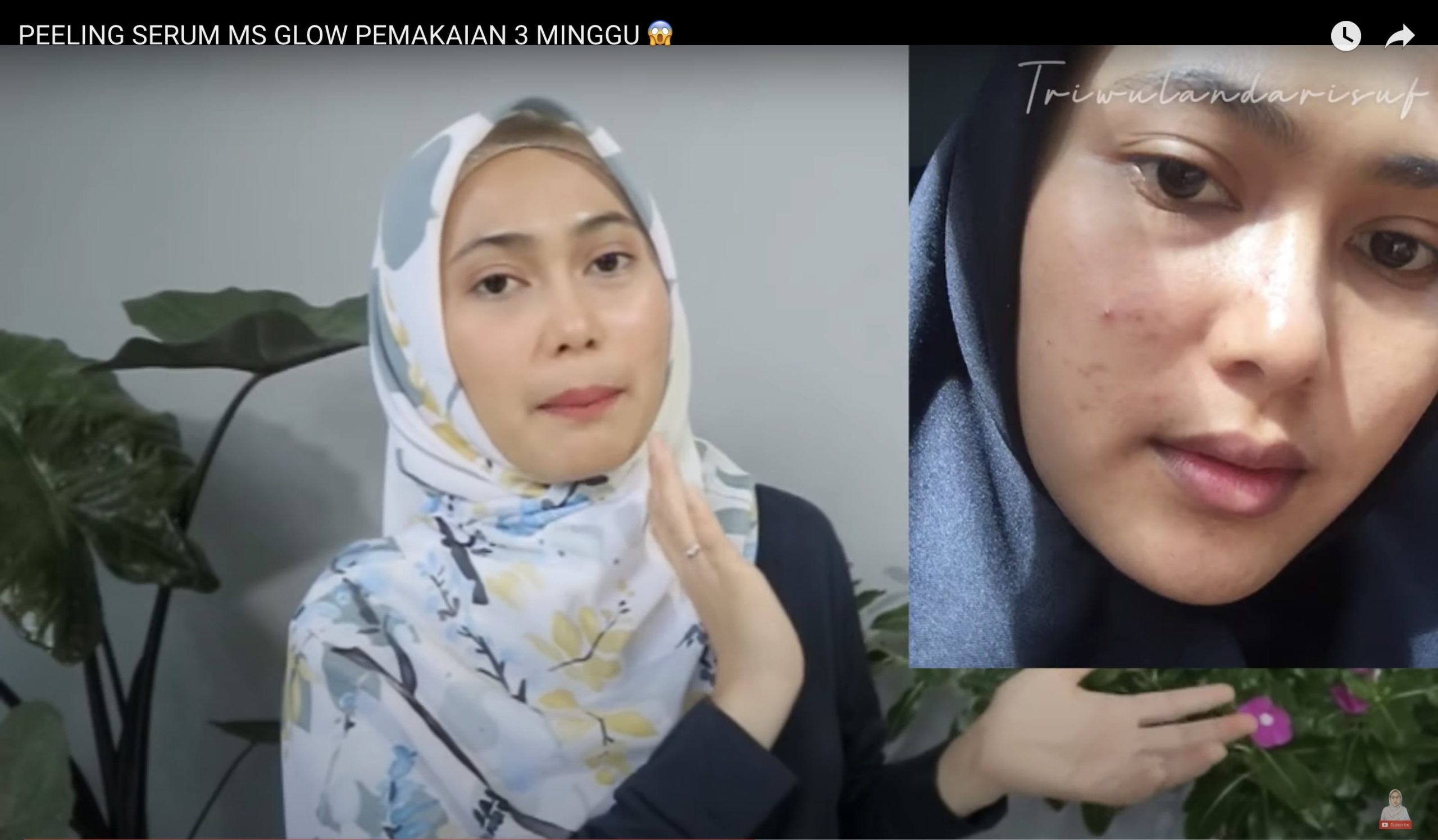 MS Glow Peeling Serum Review Product, Buat Wajah Glowing!