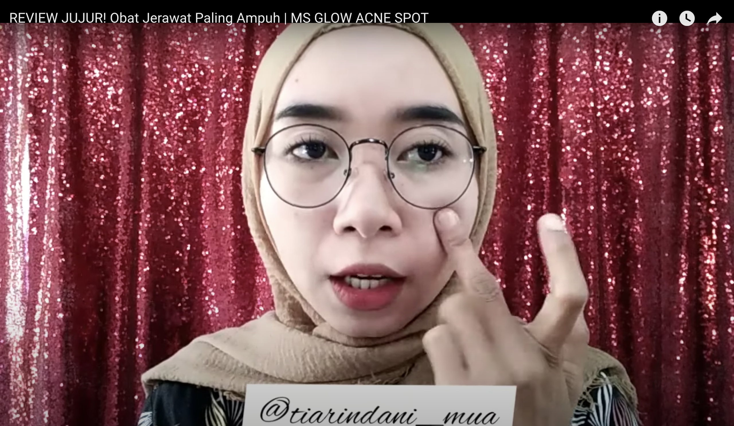 Review Produk Acne Spot MS Glow, Solusi Atasi Jerawat