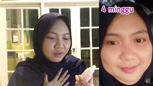 scarlett whitening brightly ever after serum