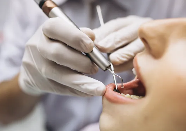 3 Rekomendasi Franchise Klinik Gigi yang Worth It, Apa Saja?