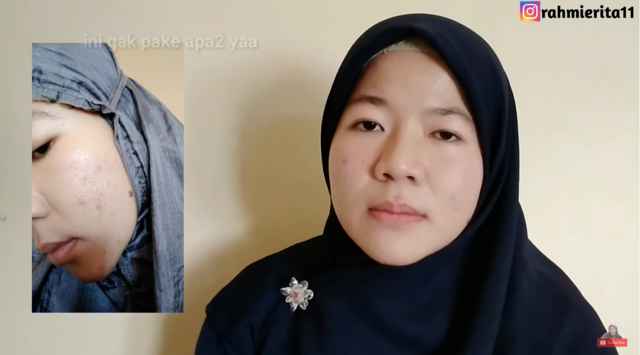 serum lifting ms glow