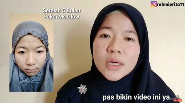 serum lifting ms glow