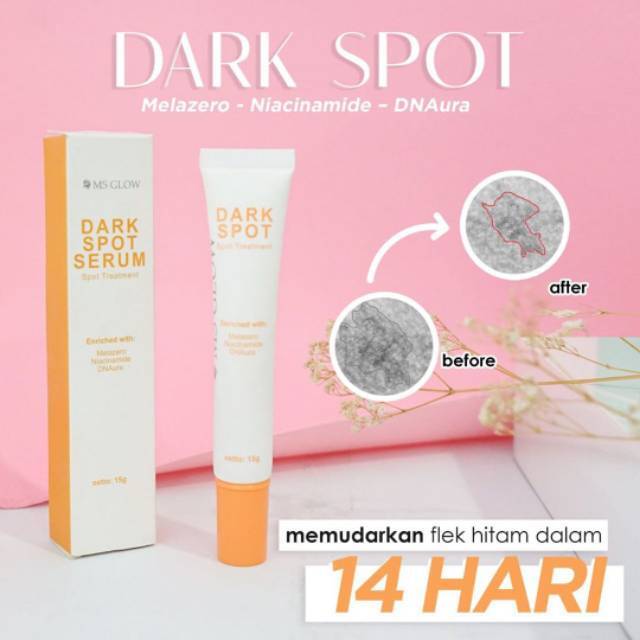 manfaat dark spot ms glow